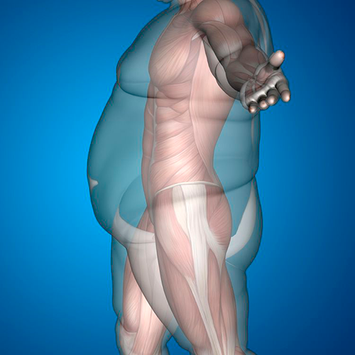 bariatric surgery statistics numbers